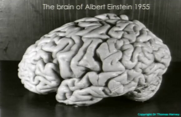 دماغ ألبرت اينشتاين